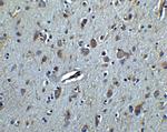 TET3 Polyclonal Antibody