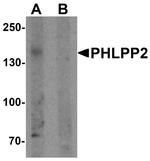 PHLPP2 Antibody in Western Blot (WB)