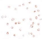 EPM2A Polyclonal Antibody