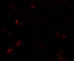 EPM2A Antibody in Immunocytochemistry (ICC/IF)