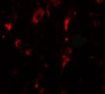 SGSM2 Polyclonal Antibody