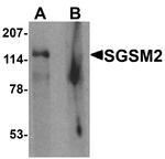 SGSM2 Antibody in Western Blot (WB)