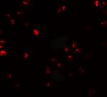 FAM193B Polyclonal Antibody