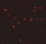 DDX60 Polyclonal Antibody