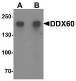 DDX60 Antibody in Western Blot (WB)