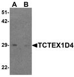 TCTEX1D4 Antibody in Western Blot (WB)