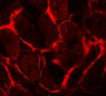 FLT3 Polyclonal Antibody