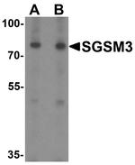 SGSM3 Antibody in Western Blot (WB)
