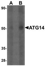ATG14 Antibody in Western Blot (WB)