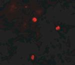 KEAP1 Polyclonal Antibody