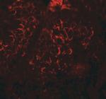 DCP2 Polyclonal Antibody