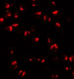 TNFAIP2 Antibody in Immunocytochemistry (ICC/IF)
