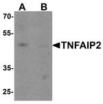 TNFAIP2 Antibody in Western Blot (WB)