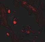 LNPEP Polyclonal Antibody