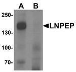 LNPEP Antibody in Western Blot (WB)