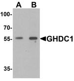 GHDC Antibody in Western Blot (WB)