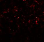 C/EBP delta Polyclonal Antibody