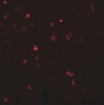 LMX1A Antibody in Immunohistochemistry (IHC)