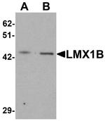 LMX1B Polyclonal Antibody