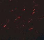 FMNL1 Polyclonal Antibody