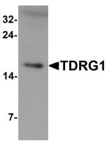 TDRG1 Antibody in Western Blot (WB)