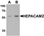 HEPACAM2 Polyclonal Antibody