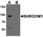 SHROOM1 Polyclonal Antibody