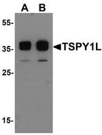 TSPY1L Polyclonal Antibody