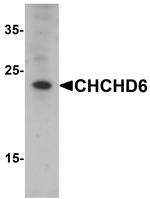 CHCHD6 Polyclonal Antibody