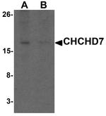CHCHD7 Polyclonal Antibody
