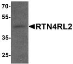RTN4RL2 Polyclonal Antibody