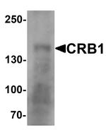CRB1 Polyclonal Antibody