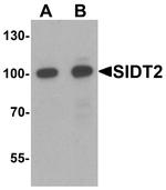 SIDT2 Polyclonal Antibody