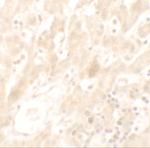 DHX36 Polyclonal Antibody