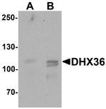 DHX36 Antibody in Western Blot (WB)