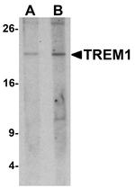 TREM1 Polyclonal Antibody