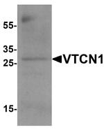 B7-H4 Polyclonal Antibody