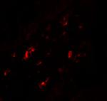 CRTH2 Polyclonal Antibody