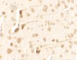 TPT1 Polyclonal Antibody