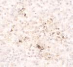 MCP-1 Polyclonal Antibody