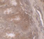 GILZ Polyclonal Antibody