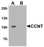 Cyclin T1 Antibody in Western Blot (WB)