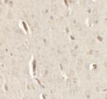 GRIP1 Antibody in Immunohistochemistry (IHC)