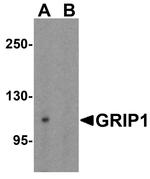 GRIP1 Antibody in Western Blot (WB)
