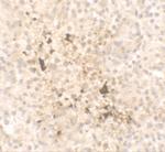 IL-15 Polyclonal Antibody