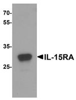 IL15RA Polyclonal Antibody