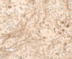 PIBF1 Polyclonal Antibody