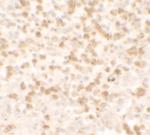 TARC Polyclonal Antibody