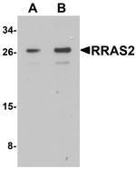 RRAS2 Polyclonal Antibody