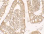 RC3H1 Polyclonal Antibody